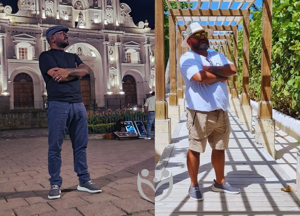 Johnny Rodríguez antes y después de la cirugía bariátrica: 85 libras de diferencia